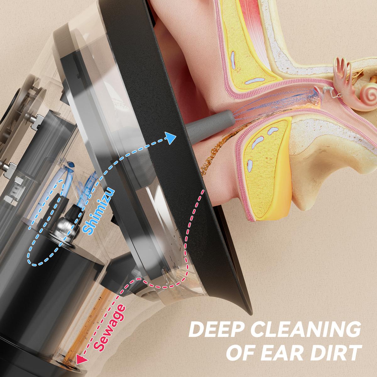 E80 Upgraded 2-in-1 Ear Wax Removal Kit with Built-in Waste Tank